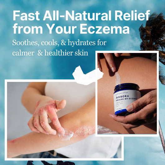 Arbora™ Eczema Soothing Cream